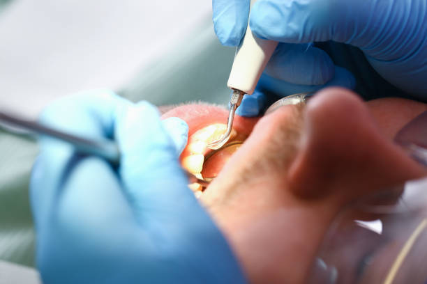 Best Pediatric Emergency Dentist in Staunton, VA