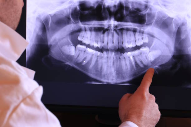 Best Emergency Tooth Extraction in Staunton, VA