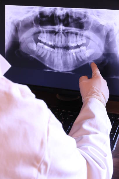 Best Emergency Tooth Extraction in Staunton, VA