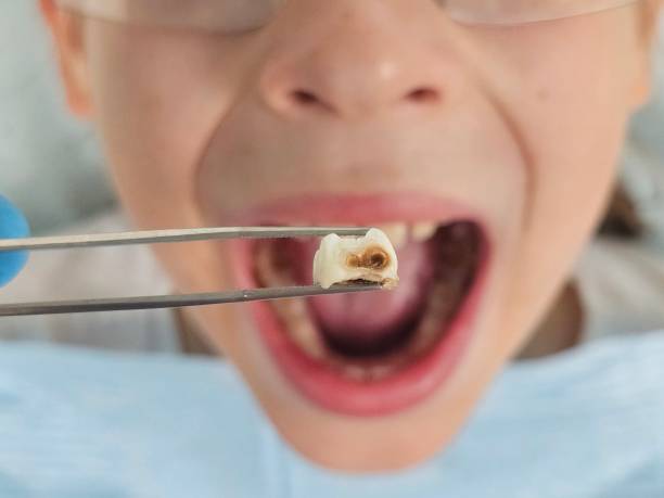 Best After-Hours Emergency Dentist in Staunton, VA